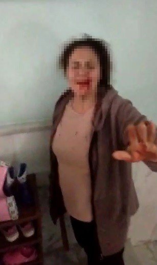 Komşu Kavgasında Ortalık Savaş Alanına Döndü: 3 Yaralı