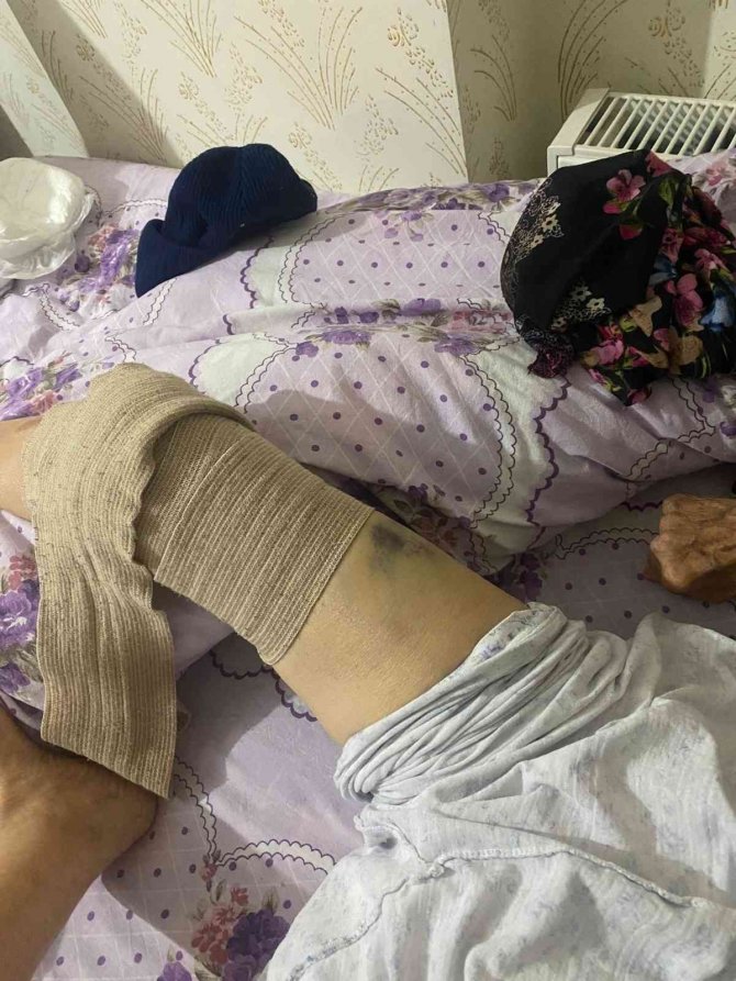 Ankara’da Bakıcı Dehşeti: 91 Yaşındaki Yaşlı Kadın Hastanede Ölüm Kalım Savaşı Veriyor