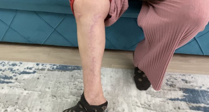 Silahlı Saldırıda Sakat Kalan Kadın Kayınbiraderinin Gereken Cezayı Almasını İstedi