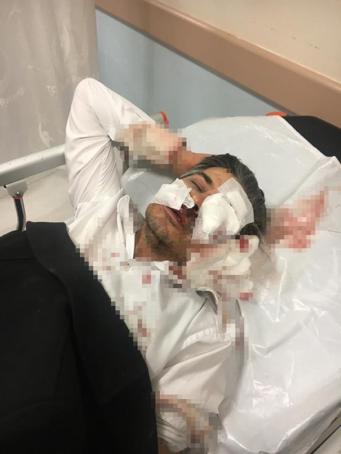 Sivas Ziraat Odası Sekreteri’ne Saldırı