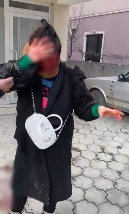 Sokak Ortasında Dehşeti Yaşayan Kadın: “Ölmek İstemiyorum”