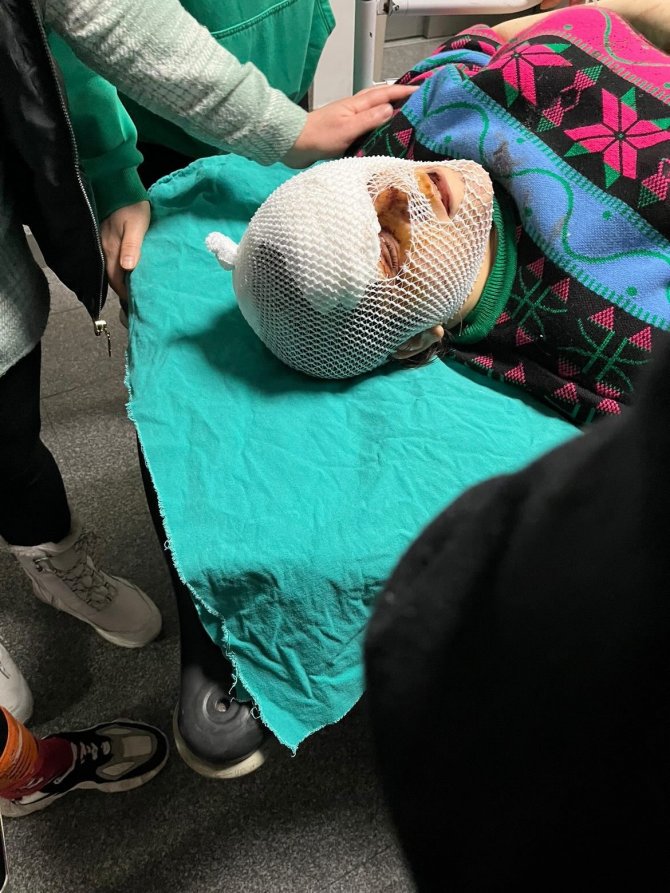 Sokak Ortasında Dehşeti Yaşayan Kadın: “Ölmek İstemiyorum”