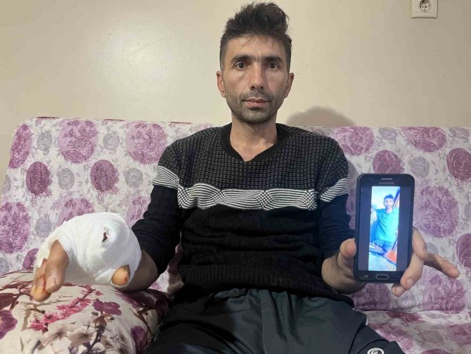 Komşusunun Köpeğinin Saldırısına Uğrayan Vatandaşın Parmağı Koptu, Eli Parçalandı