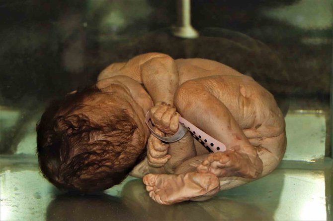 İ̇nsanlar Eskiden Bu Aletlerle Tedavi Ediliyordu