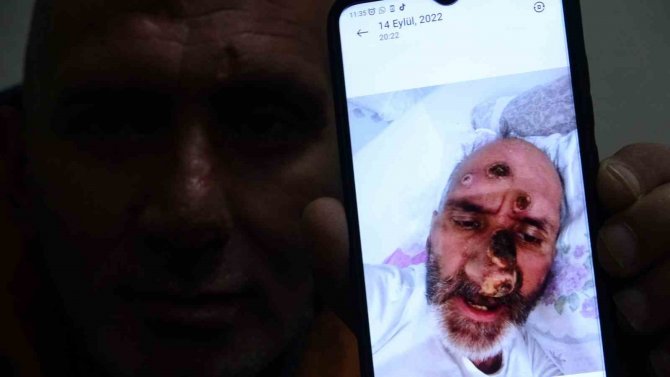 Antalya’ya Çalışmak İçin Gitti Hayatının Şokunu Yaşadı