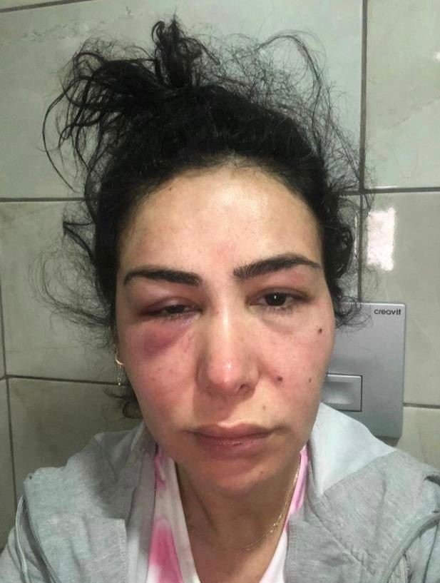 Darp Eden Şahıs Serbest Kalınca Panik Butonu Verildi
