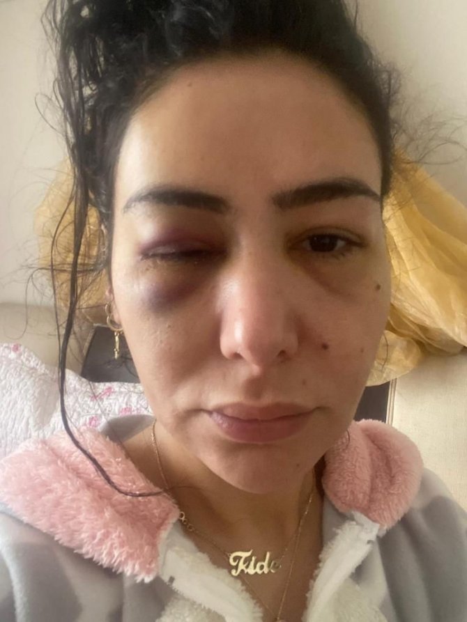 Darp Eden Şahıs Serbest Kalınca Panik Butonu Verildi