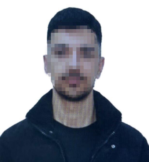 21 Yaşındaki Genç Kadın Eski Sevgilisi Tarafından Kezzapla Yaralandı