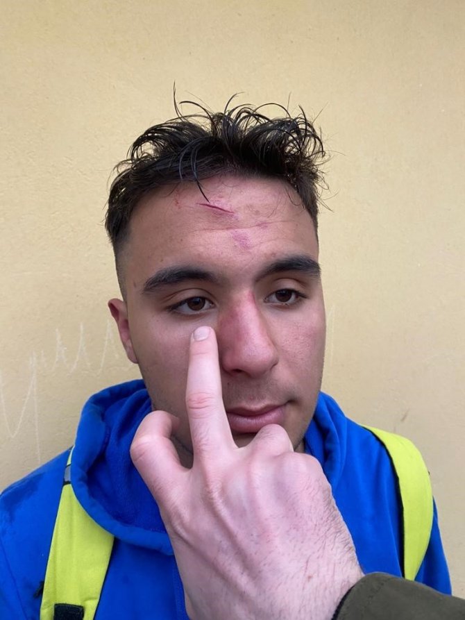 Amatör Küme Maçında Olay