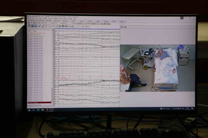 Diyarbakır’da Epilepsi Hastalarına Video Eeg Sistemi İle Tanı Konuluyor