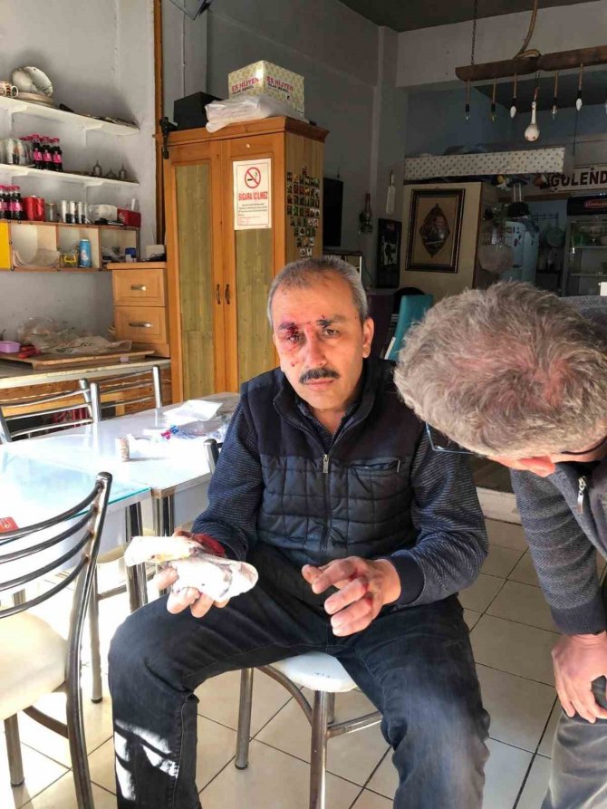 Köyceğiz’de Alev Alan Akü Bir Kişiyi Yaraladı
