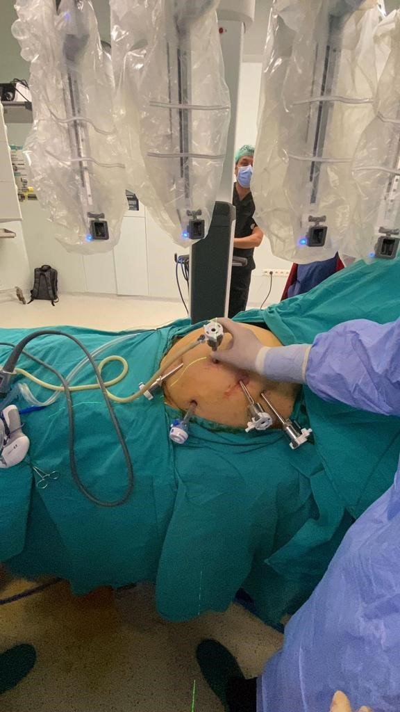 Kolon Kanseri Tedavisinde Kullanılan Robotik Cerrahi İle Hastalar Daha Hızlı Taburcu Ediliyor