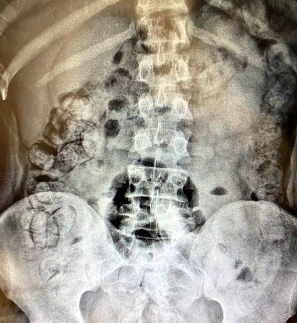 Midede Uyuşturucu Sevkiyatı