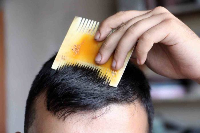 Sivas Kemik Tarağı Coğrafi İşaret Tescili Aldı