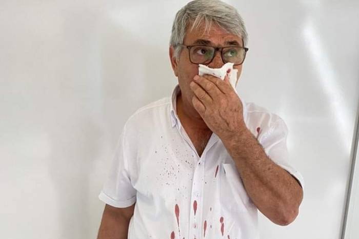 İzmir’de Chp’li Belediye Başkan Yardımcısı’ndan Muhtara Dayak