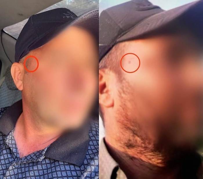 Jandarma Korkusundan Yüzündeki Beni Aldırdı