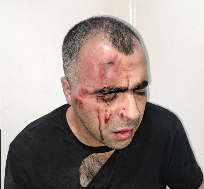 Bigacem Başkanı Aygül’e Saldırıya İlişkin 1’i Polis 2 Kişi Gözaltına Alındı