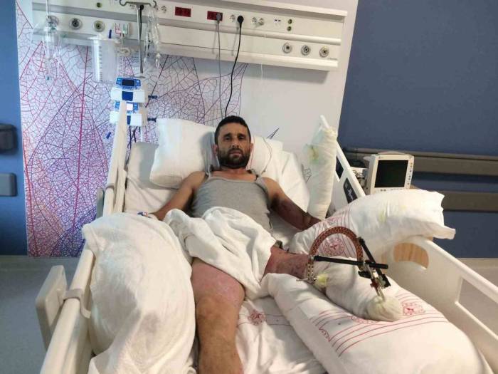 İş Kazasında Ayağını Kaybeden Baba: "çocuklarımın Okumasını İstiyorum"