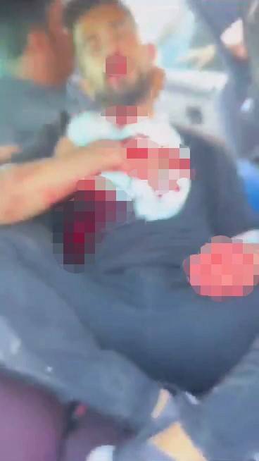 Şanlıurfa’da Akraba İki Aile Arasında Silahlı Kavga: 1’i Ağır 5 Yaralı