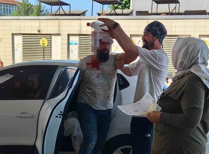 Bursa’da Kendini Kesen Acemi Kasap Sayısı 462 Oldu