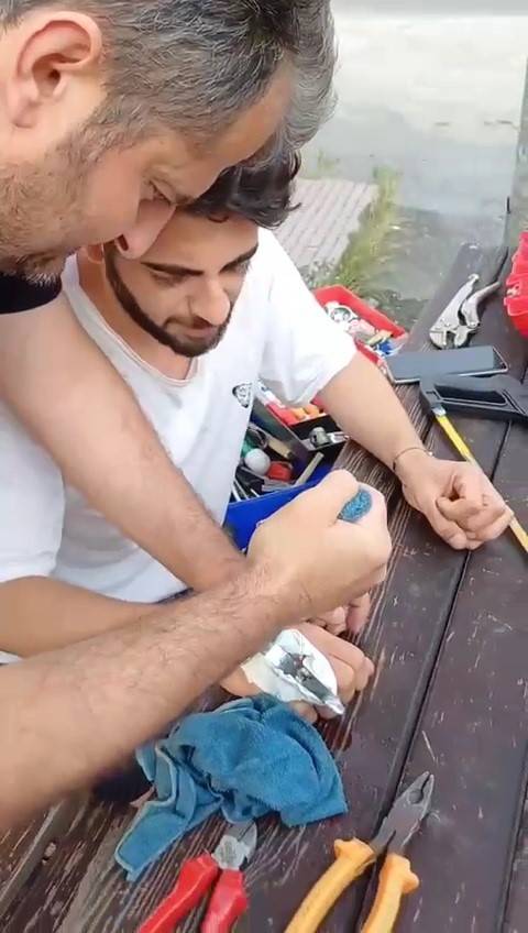 Parmağına Sıkışan Yüzük Spiral Makinesi İle Kesilerek Çıkarıldı