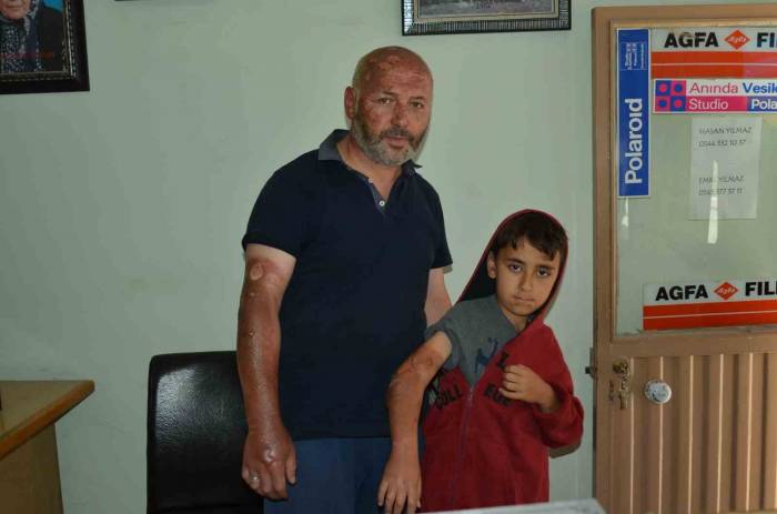 Piknik Alanında Yakılan Çöpler Patladı: 1’i Çocuk 2 Yaralı