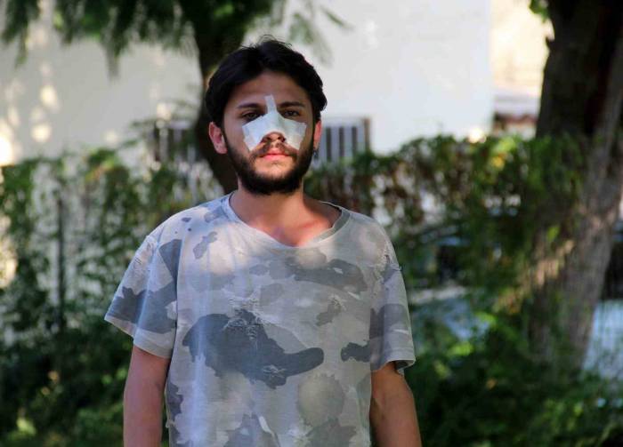 Antalya’da Kiracı Gence "ucuz Kira" Dayağı İddiası