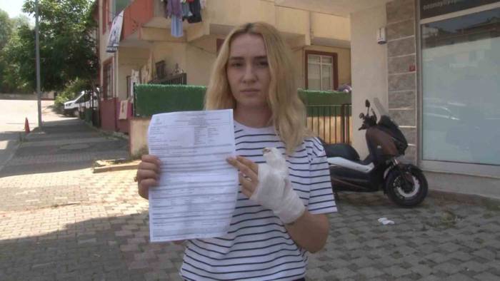 Sultanbeyli’de X-ray Krizi: İş Arkadaşının Parmağını Isırdı