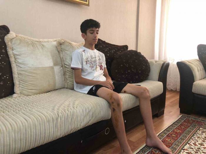 Köpeklerin Saldırdığı 13 Yaşındaki Çocuk Ölümden Döndü