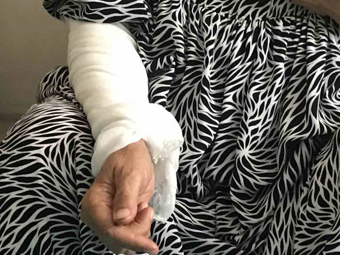 74 Yaşındaki Kadın, Taş Ve Sopalı Saldırıda Darp Edilme Anlarını Anlattı