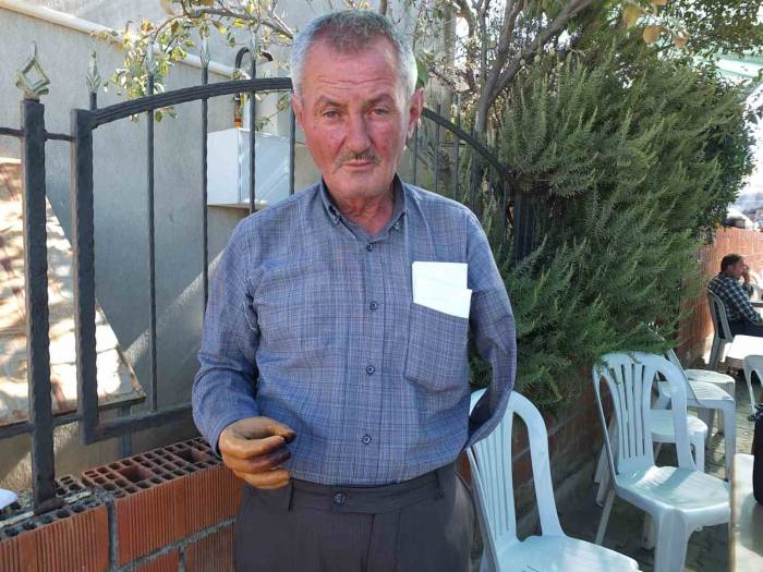 Protez Kol İçin 400 Bin Liraya İhtiyacı Var