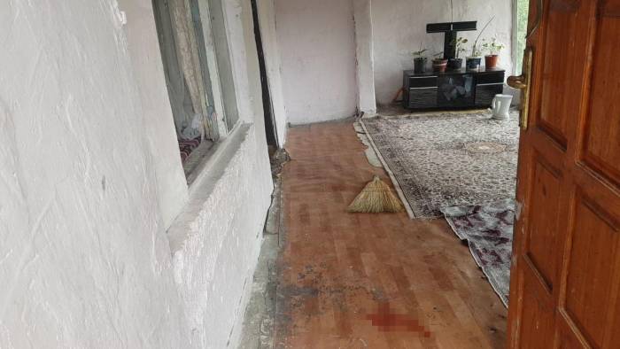 Kafası Üzerine Düşen Çocuk Yaralandı