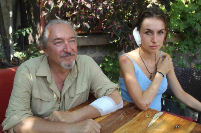 Sokak Köpeği Turistlere Saldırdı: 2 Yaralı