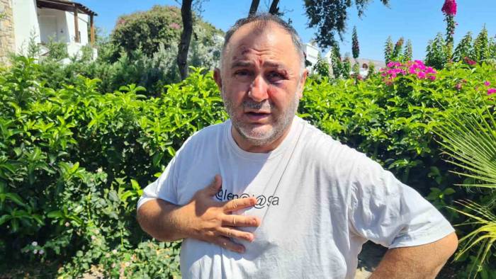 Spor Yorumcusu Ve İşletmeci Levent Bulut Öldüresiye Dövülüp Gasp Edildi