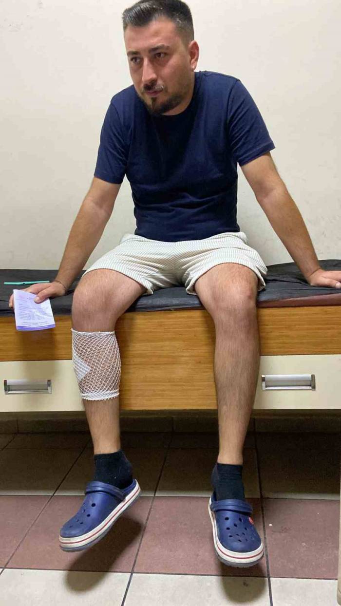 Sokak Köpekleri Motosikletli Gence Saldırıp Bacağından Isırdı