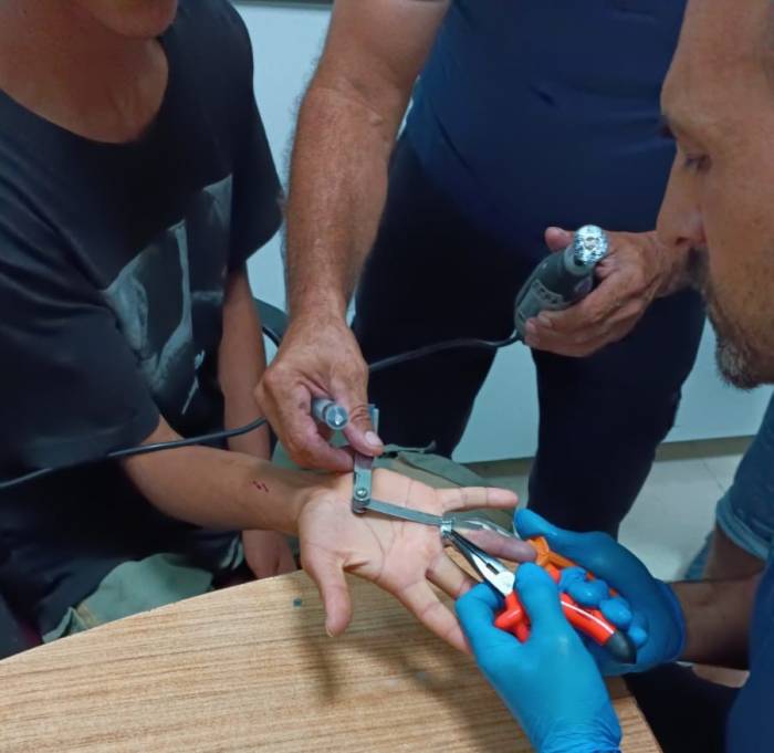 Parmağa Sıkışan Yüzük Kesilerek Çıkarıldı