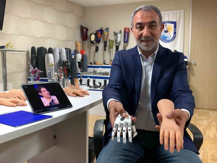 Yarışmadan 1 Milyon Lira Kazanan Rabia’nın Protezini İş Adamı Karşılayacak