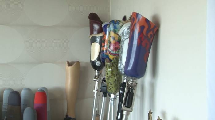 Kırşehirli İş Adamı Düger, 20 Depremzedeye Ücretsiz Protez Temini Gerçekleştirdi