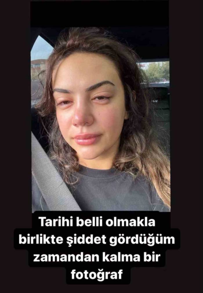 Ece Ronay’a Eski Eşinden Şiddet