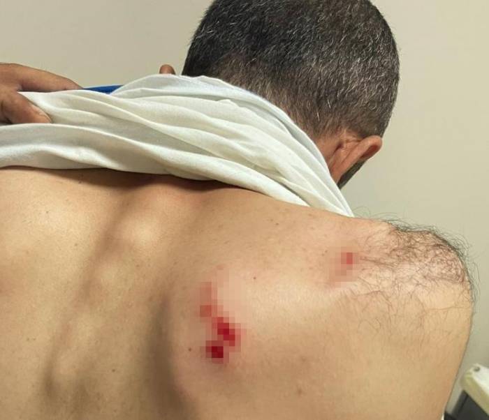 Siirt’te Enerji Şirketi Saha Ekibine Saldırıda 2 Personel Yaralandı