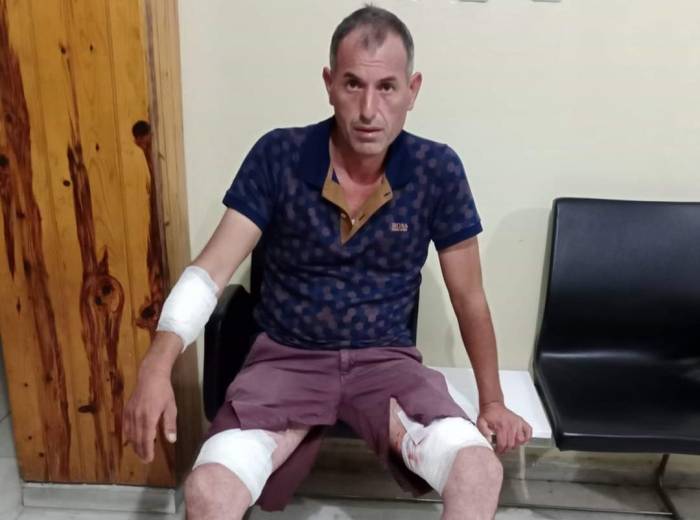 Sokak Köpeklerinin Saldırısına Uğrayan Ersoy İsyan Etti