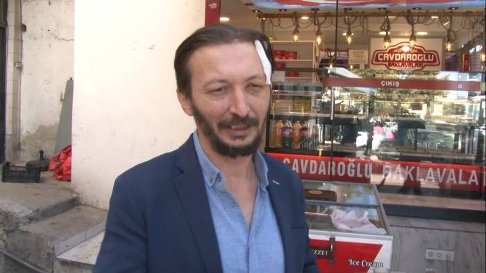 ‘Ne Bakıyorsun’ Deyip Esnafı Kafasından Bıçaklayıp Kaçtılar