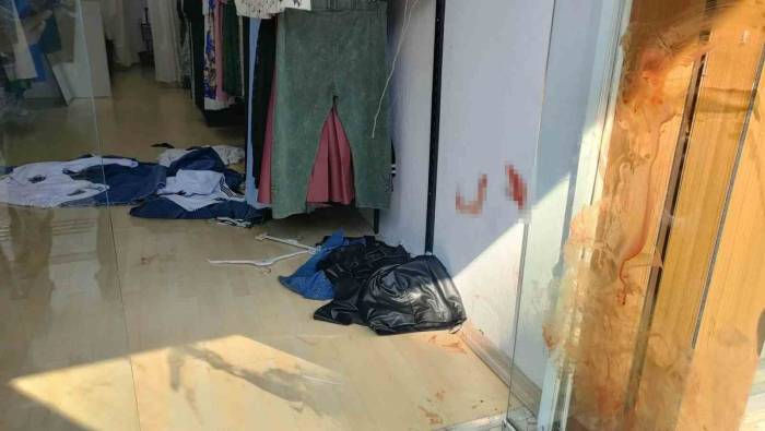 Antalya’da Bıçaklı Kavga: 1 Yaralı