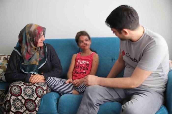 6 Yıldır Cilt Kanseri İle Savaşan Küçük Cemile, Gün Yüzü Görmek İstiyor
