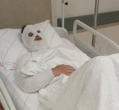 Eski Nişanlısına Kimyasal Sıvı Atan Kişiye 15 Yıl Hapis Cezası