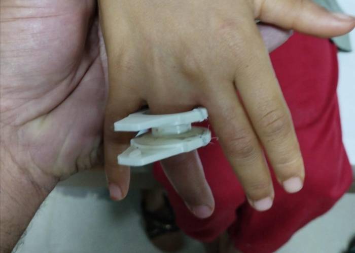 Parmağına Plastik Parçası Sıkışan Çocuğu İtfaiye Kurtardı