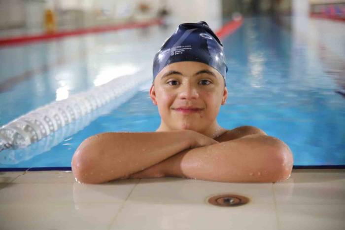 +1 Kromozom Başarılarına Ve Zorlu Hastalıkları Yenmesine Engel Olmadı