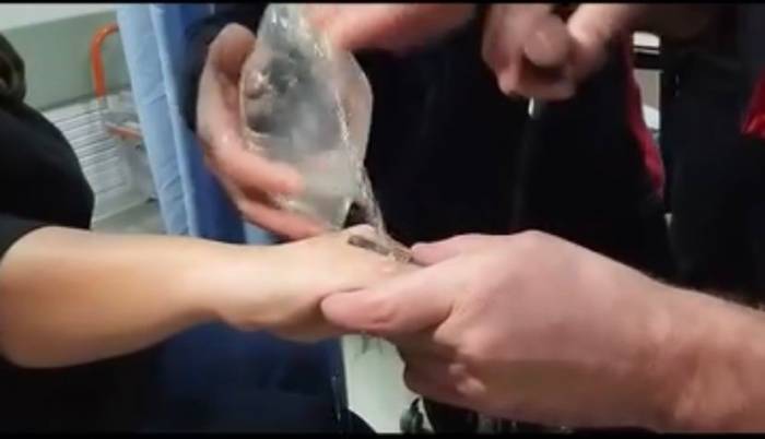 Elazığ’da Parmağa Sıkışan Yüzüğü İtfaiye Ekipleri Çıkardı