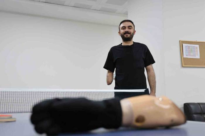 Sağ Eli Ve Sol Dizini Kaybetti, Yaşam Sevincini Kaybetmedi