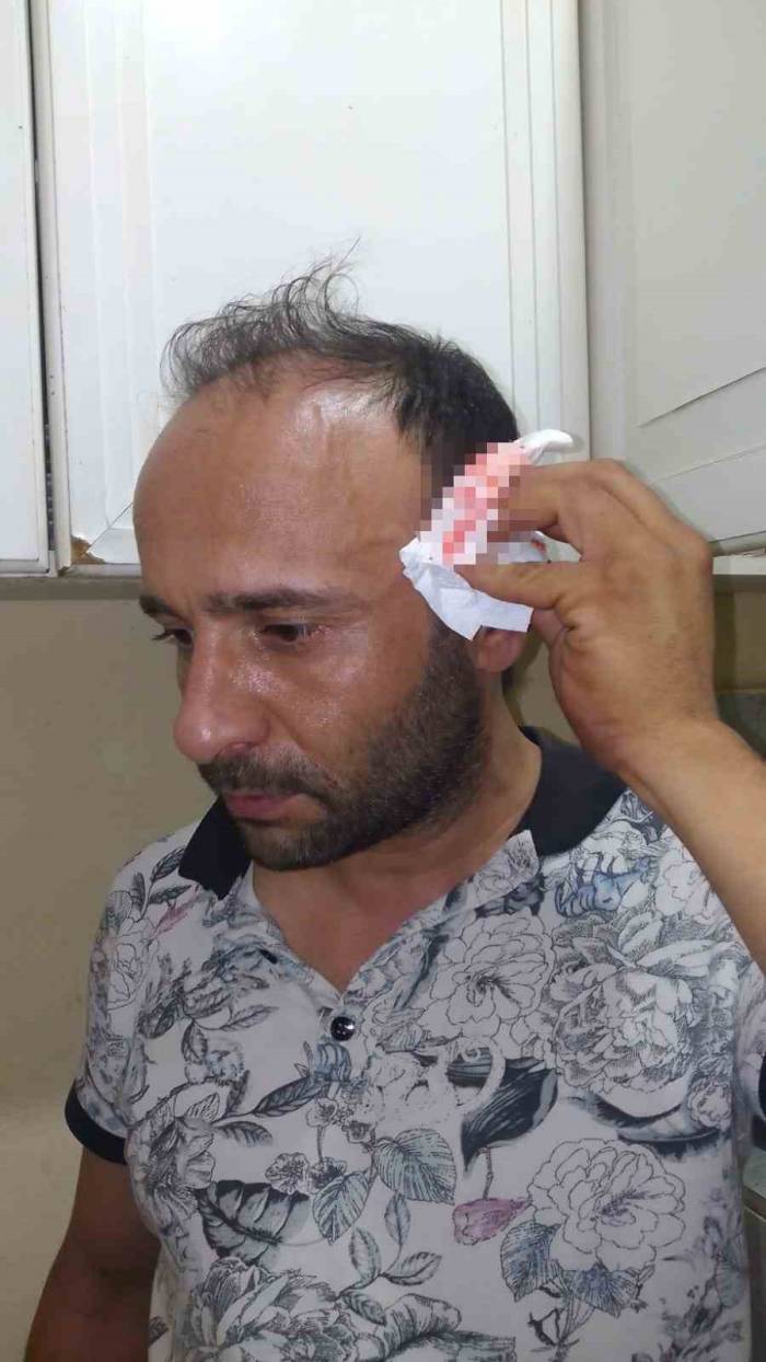 Kartal’da Ev Sahibinin Oğlu, Kira Zammını Kabul Etmeyen Kiracısını Darp Etti